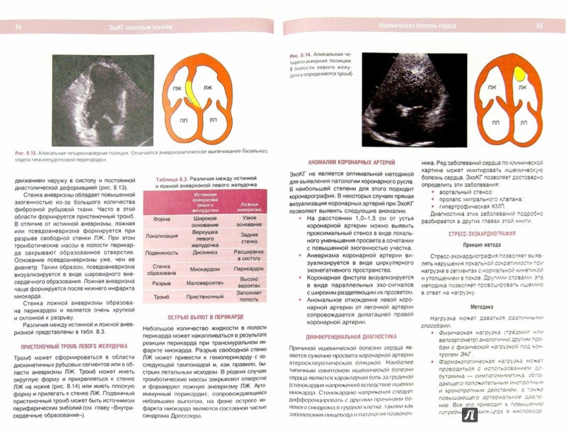 ЭхоКГ понятным языком. 3-е изд. Лутра А.