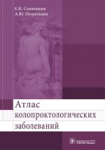 Атлас колопроктологических заболеваний : учеб. пособие / Е. И. Семионкин, А. Ю. Огорельцев. — М. : ГЭОТАР-Медиа, 2016. — 80 с. : ил.