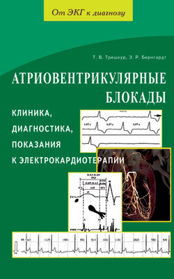 Атриовентрикулярные блокады. Клиника, диагностика, показания к электрокардиотерапии