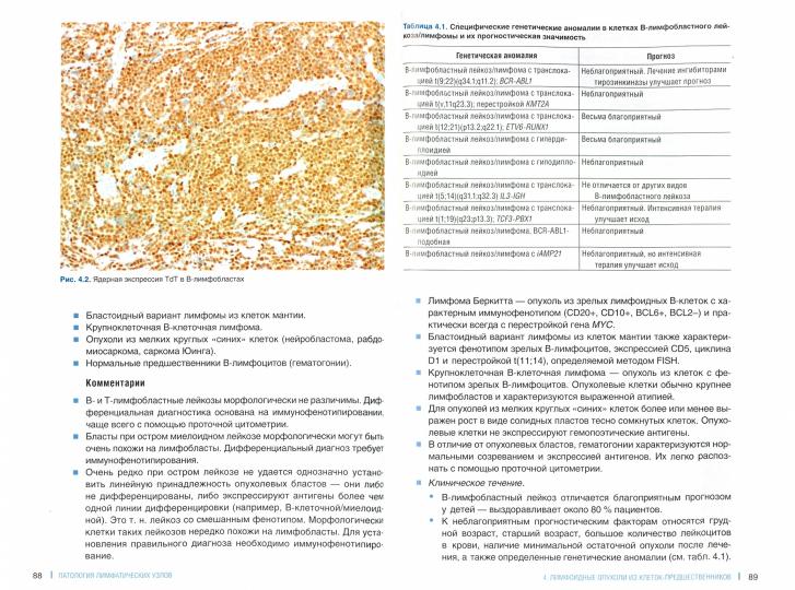 Патология лимфатических узлов для клиницистов