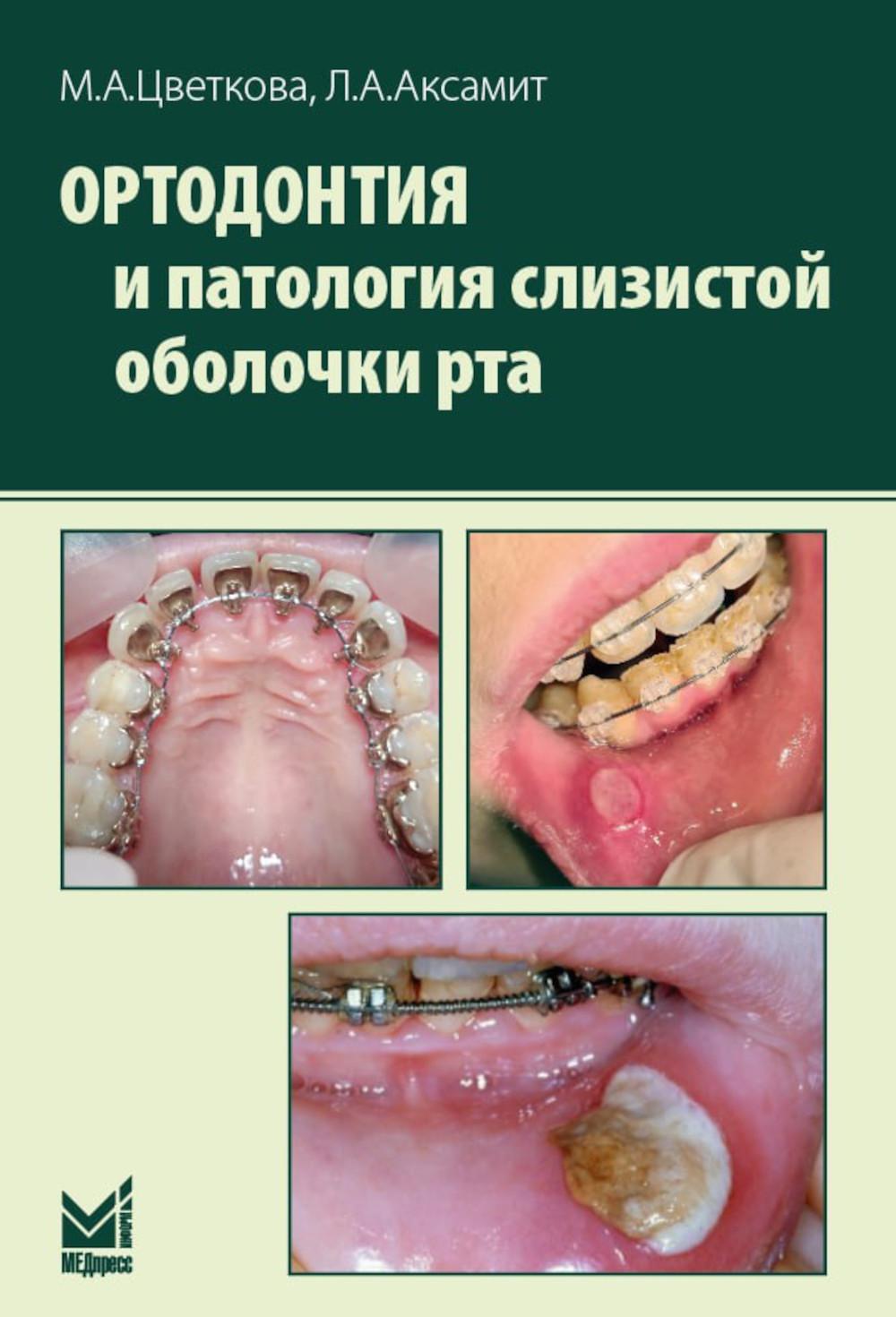 Orthodontie et pathologie des patients atteints de la maladie