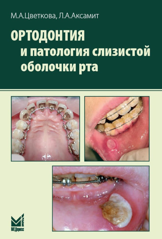 Orthodontie et pathologie des patients atteints de la maladie