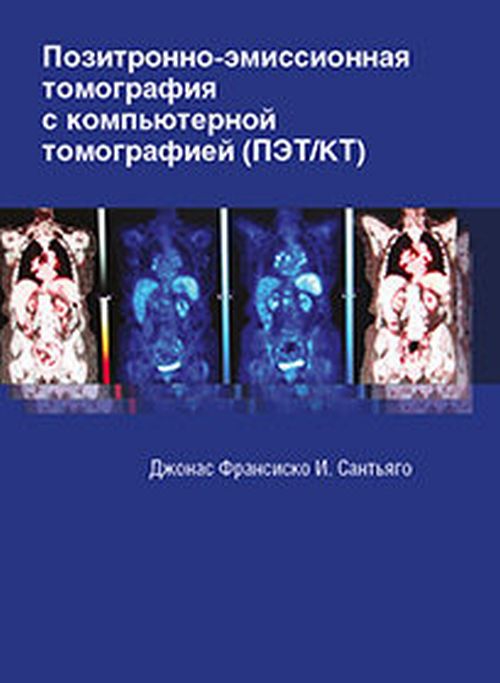 La tomographie positive avec la tomographie informatique (ПЭТ/КТ). Джонас Франсиско И. Saint-Pétersbourg