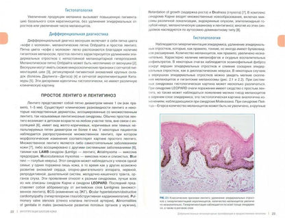 Интерпретация биопсий кожи. Первичные нелимфоидные опухоли кожи