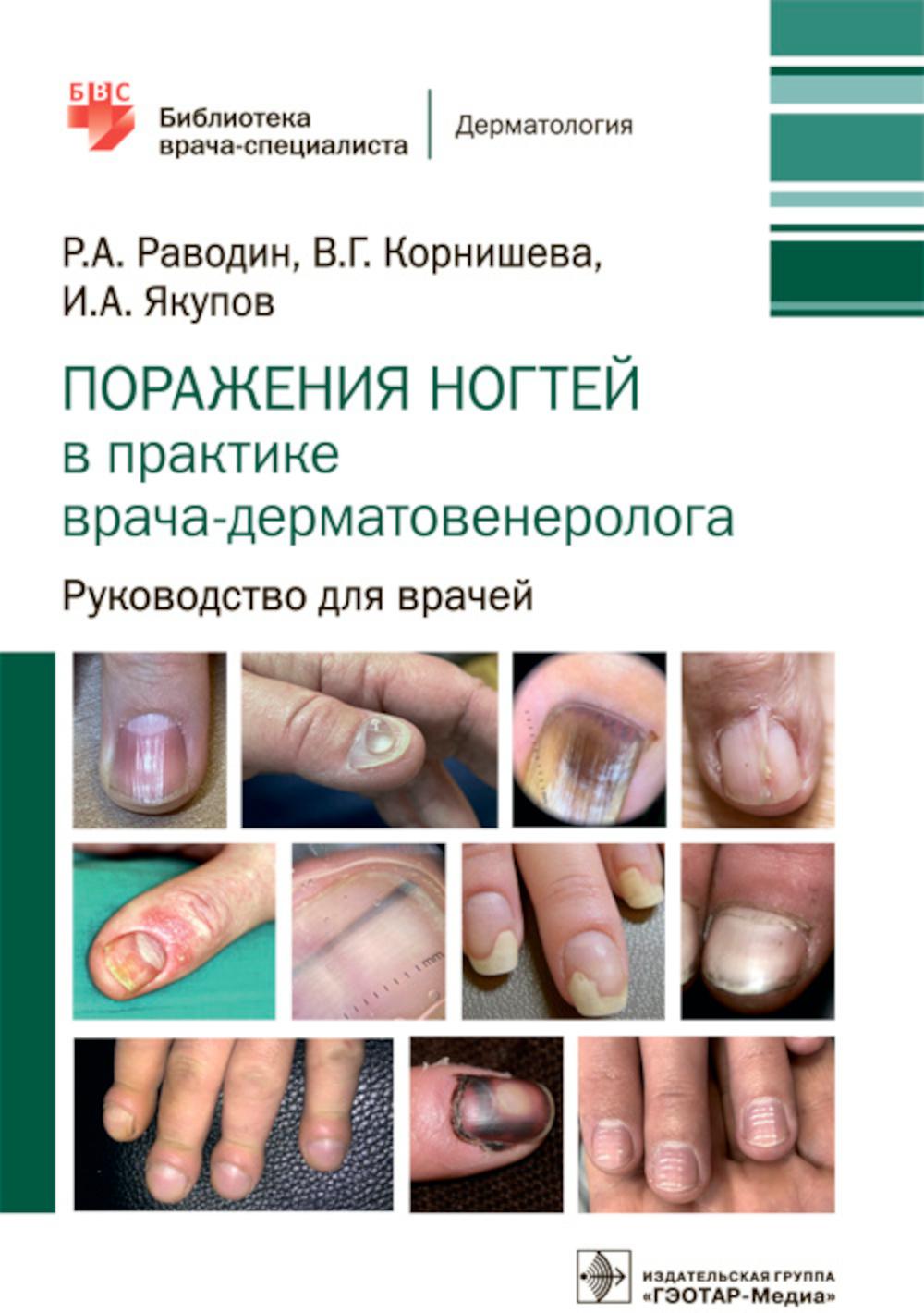 Поражения ногтей в практике врача-дерматовенеролога : руководство для врачей / Р. А. Раводин, В. Г. Корнишева, И. А. Якупов. — Москва : ГЭОТАР-Медиа, 2023. — 176 с. : ил. — (Серия «Библиотека врача-специалиста»).