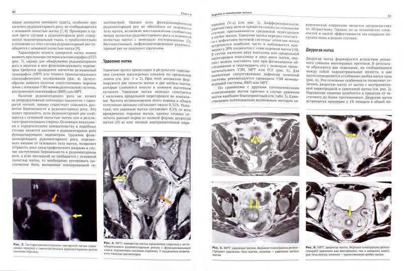 Реконструктивная и репродуктивная хирургия в гинекологии. Гомел В., Брилл Э.И.