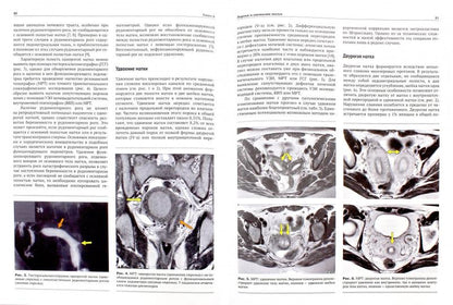 Реконструктивная и репродуктивная хирургия в гинекологии. Гомел В., Брилл Э.И.
