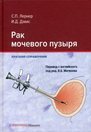 Рак мочевого пузыря. Краткий справочник