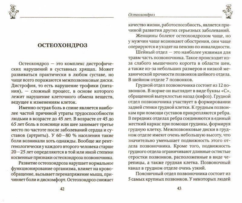 100 рецептов при остеохондрозе и отложении солей. Вкусно, полезно, душевно, целебно