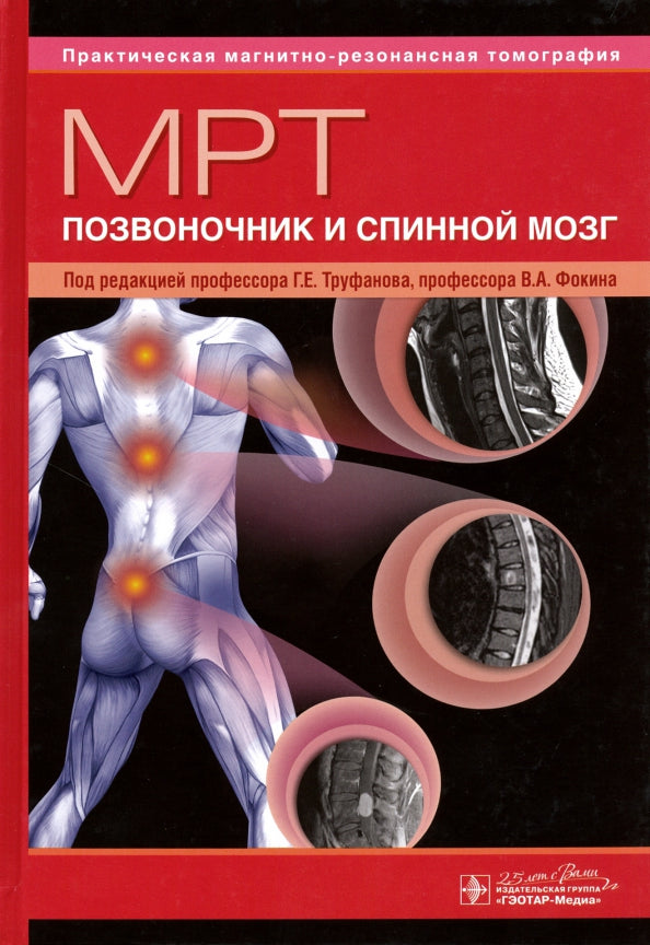МРТ. Позвоночник и спинной мозг : руководство для врачей / под ред. Г. Е. Труфанова, В. A. Fokina. — Москва : ГЭОТАР-Медиа, 2020. — 544 с. : IL. — (Серия «Практическая магнитно-резонансная томография»). — DOI : 10.33029/9704-4517-4-MRT-2020-1-544.
