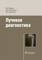 Лучевая диагностика : учеб. пособие / Е. Б. Илясова, М. Л. Чехонацкая, В. Н. Приезжева. — М. : ГЭОТАР-Медиа, 2016. — 280 с. : ил.