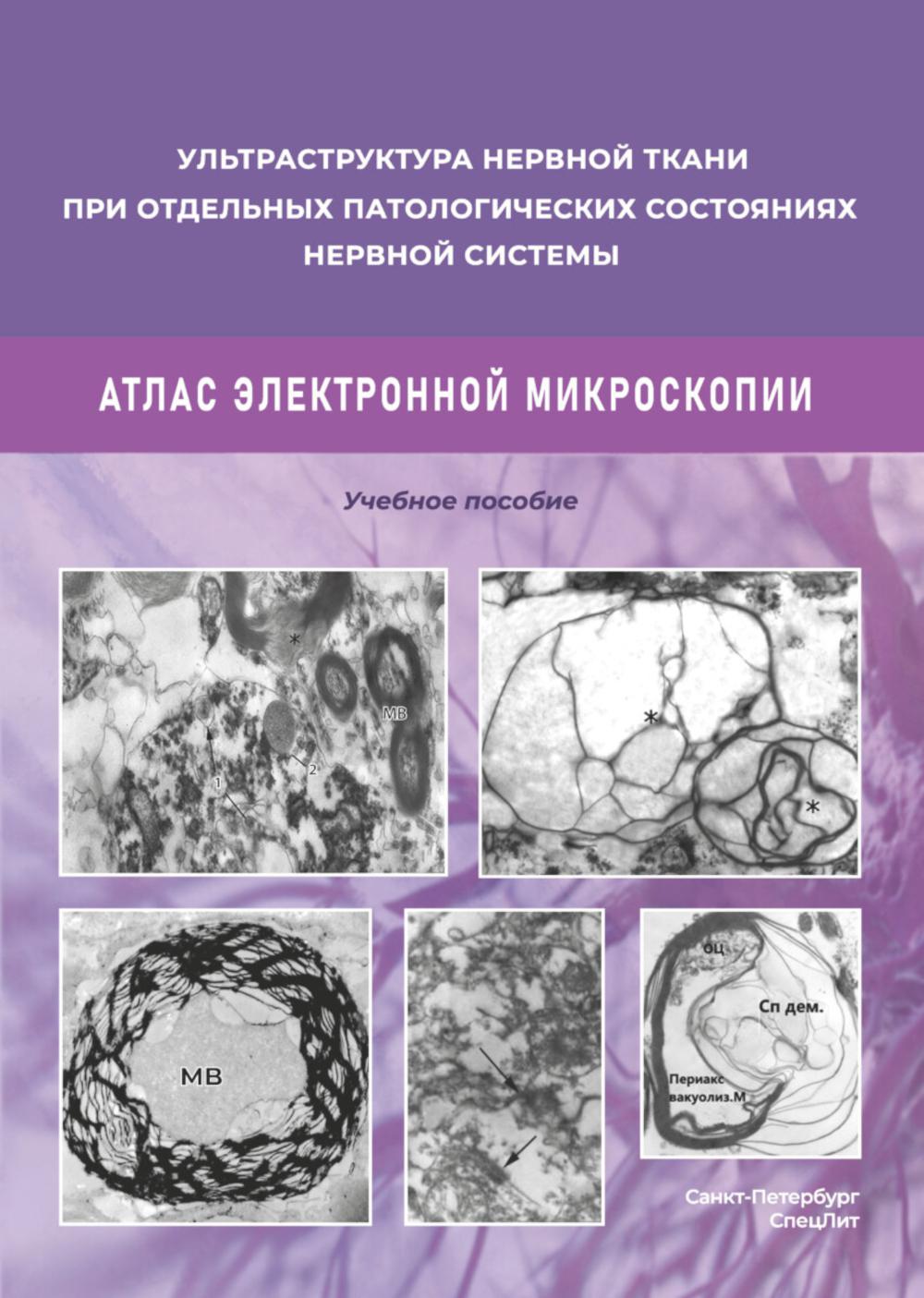 Ультраструктура нервной ткани при отдельных патологических состояниях нервной системы. Атлас электронной микроскопии: Учебное пособие