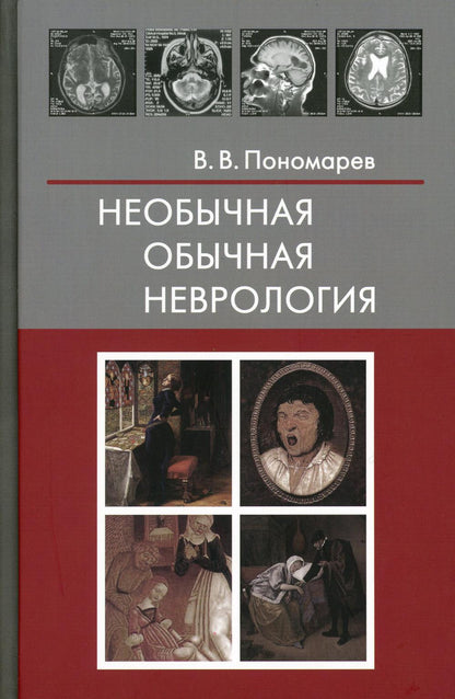 Необычная обычная неврология: руководство для врачей