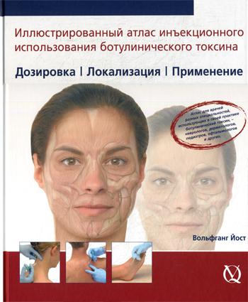 Il existe un exemple d'injection utilisant une toxine botulique. Дозировака. Localisation. Применение***. Vollfgang Ost