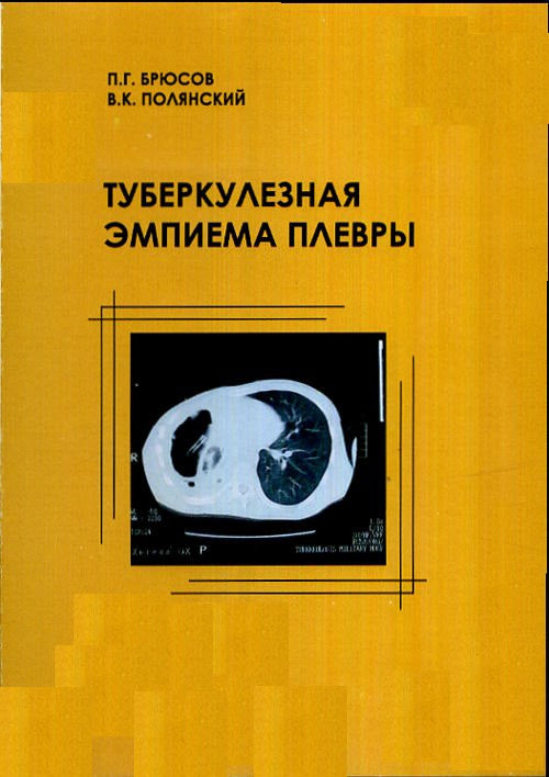 Туберкулезная эмпиема плевры
