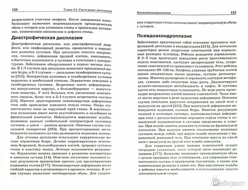 Ортопедия первых шагов. Мицкевич В.А.