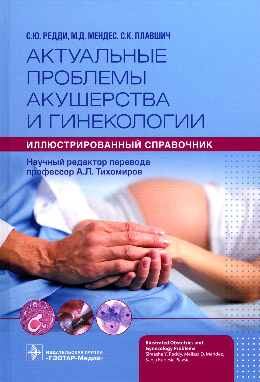 Актуальные проблемы акушерства и гинекологии: иллюстрированный справочник / С. Ю. Редди, М. Д. Мендес, С. Купешич Плавшич ; maintenant. réd. par. A. Л. Тихомиров. — Москва : ГЭОТАР-Медиа, 2023. — 464 с. : IL.