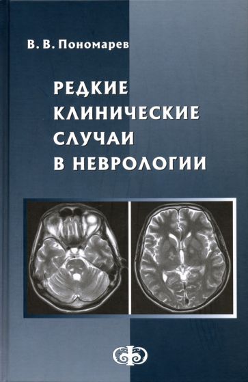 Редкие клинические случаи в неврологии (случаи из практики): Руководство для врачей