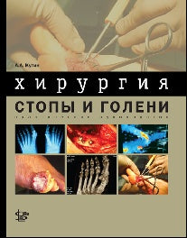 Хирургия стопы и голени: практическое руководство. Кутин А. А.