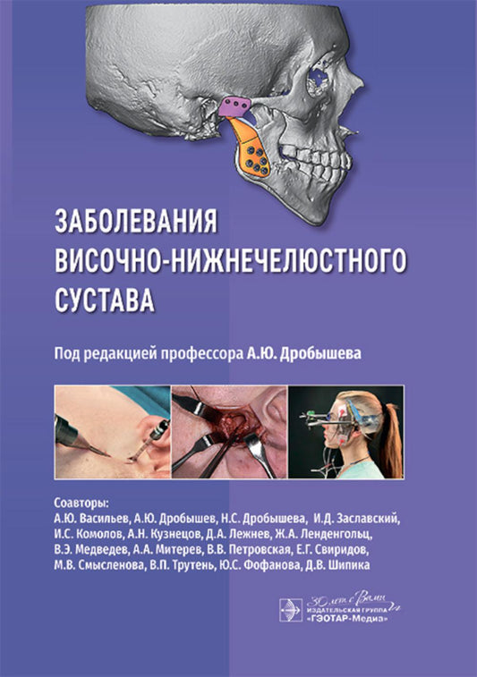 Заболевания височно-нижнечелюстного сустава