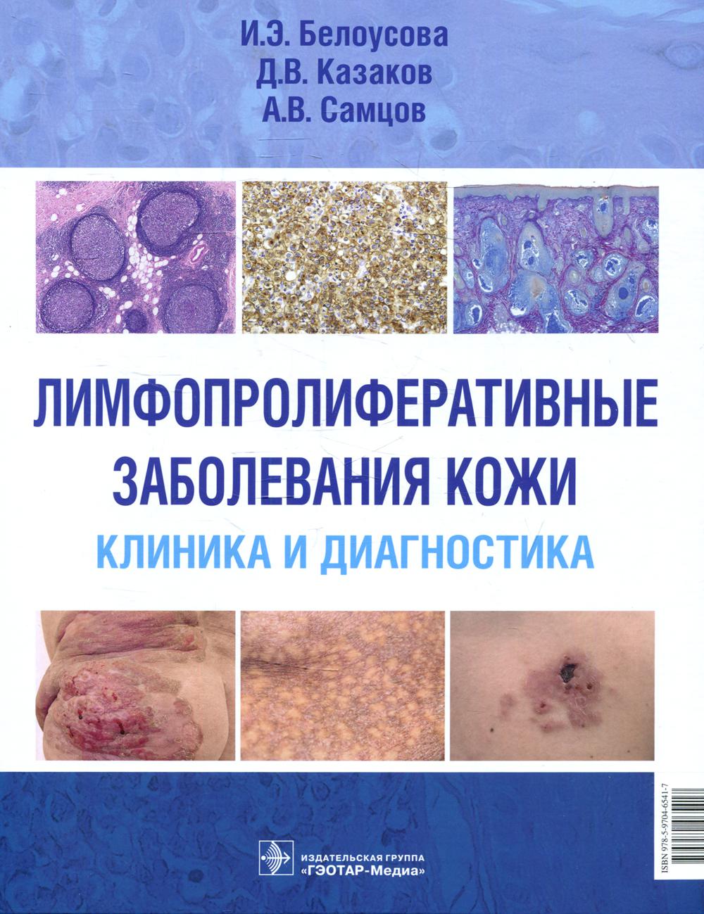 Лимфопролиферативные заболевания кожи. Клиника и диагностика (Издание предназначено дерматологам, онкологам, гематологам и патологоанатомам, а также врачам общей практики)