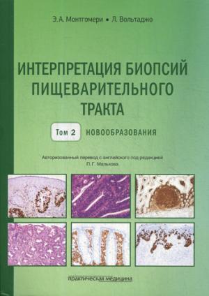 Интерпретация биопсий пищеварительного тракта. Новообразования. Том 2