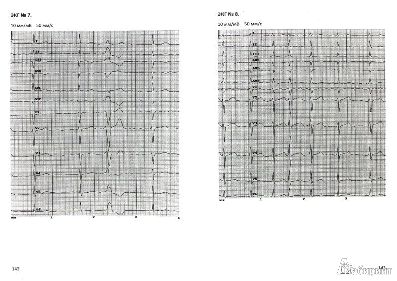 Электрокардиография: учеб. je peux