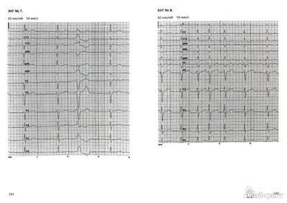 Электрокардиография: учеб. je peux