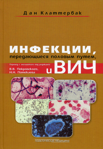 Инфекции, передающиеся половым путем, и ВИЧ-инфекция. Клаттербак Д.