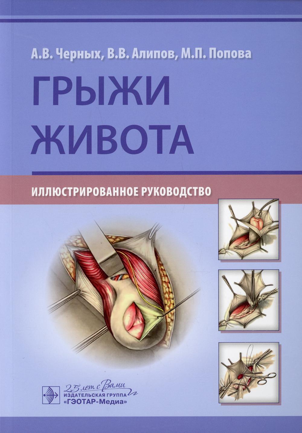 Грыжи живота : иллюстрированное руководство / А. В. Черных, В. В. Алипов, М. П. Попова. — Москва : ГЭОТАР-Медиа, 2020. — 144 с. : ил. — DOI: 10.33029/9704-5740-5-HER-2020-1-144.