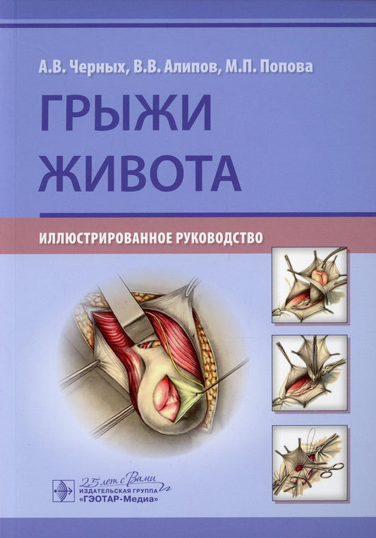 Грыжи живота : иллюстрированное руководство / А. В. Черных, В. В. Алипов, М. П. Попова. — Москва : ГЭОТАР-Медиа, 2020. — 144 с. : ил. — DOI: 10.33029/9704-5740-5-HER-2020-1-144.