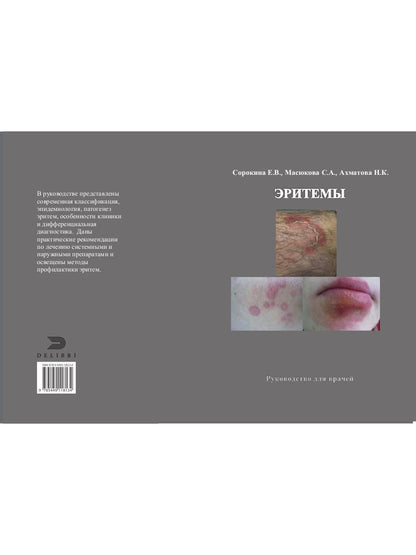 Эритемы. Руководство для врачей