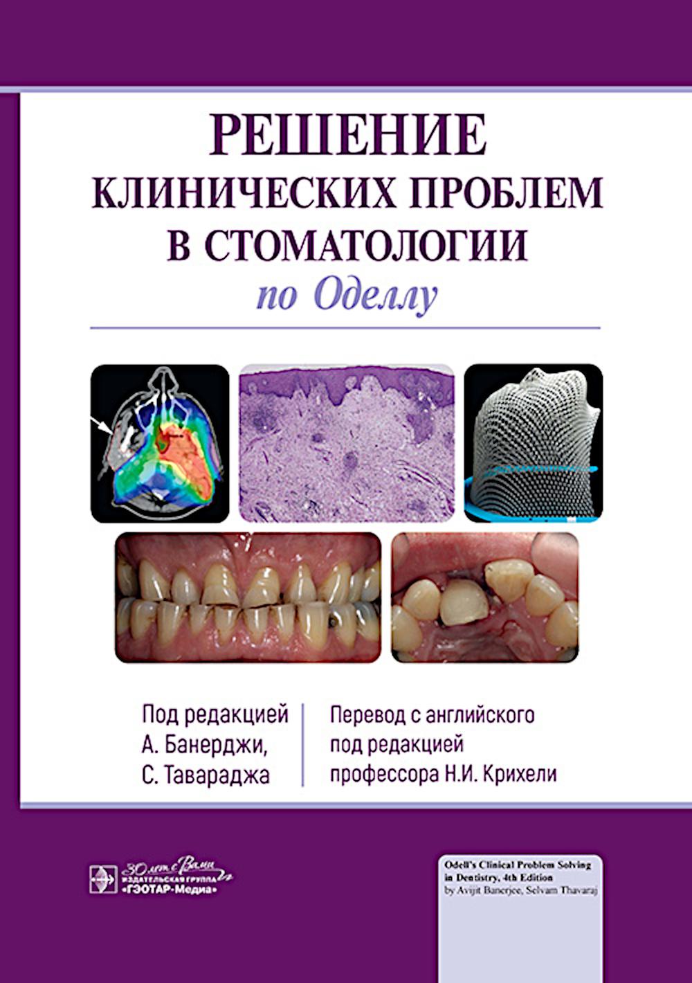 Решение клинических проблем в стоматологии по Оделлу / под ред. А. Банерджи, С. Тавараджа, пер. с англ. под ред. Н. И. Крихели. — Москва : ГЭОТАР-Медиа, 2024. — 520 с. : ил.