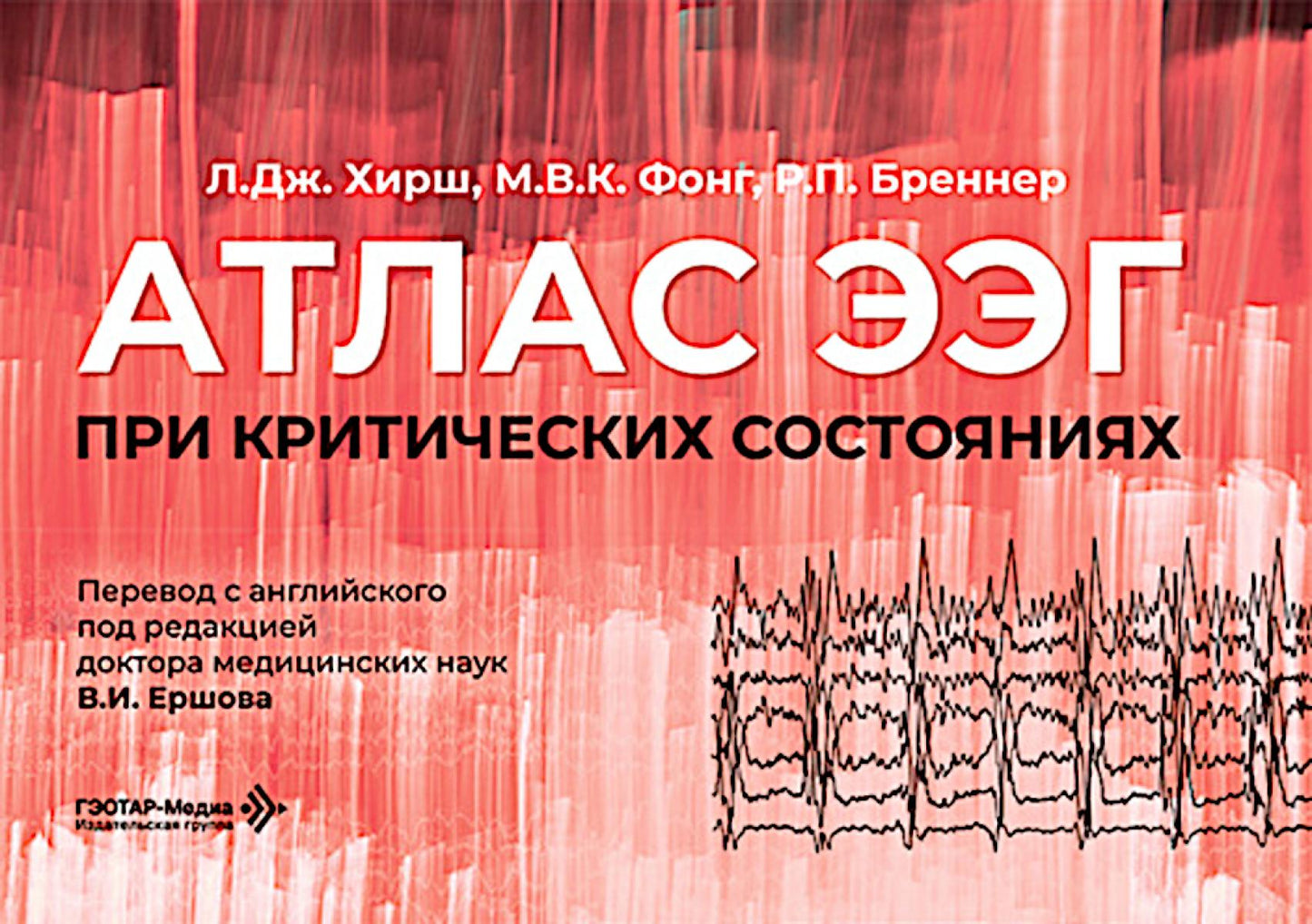 Атлас ЭЭГ при критических состояниях / Л. Дж. Хирш, М. В. К. Фонг, Р. П. Бреннер ; пер. с англ. под ред. В. И. Ершова. ― Москва : ГЭОТАР-Медиа, 2026. ― 560 с. : ил.