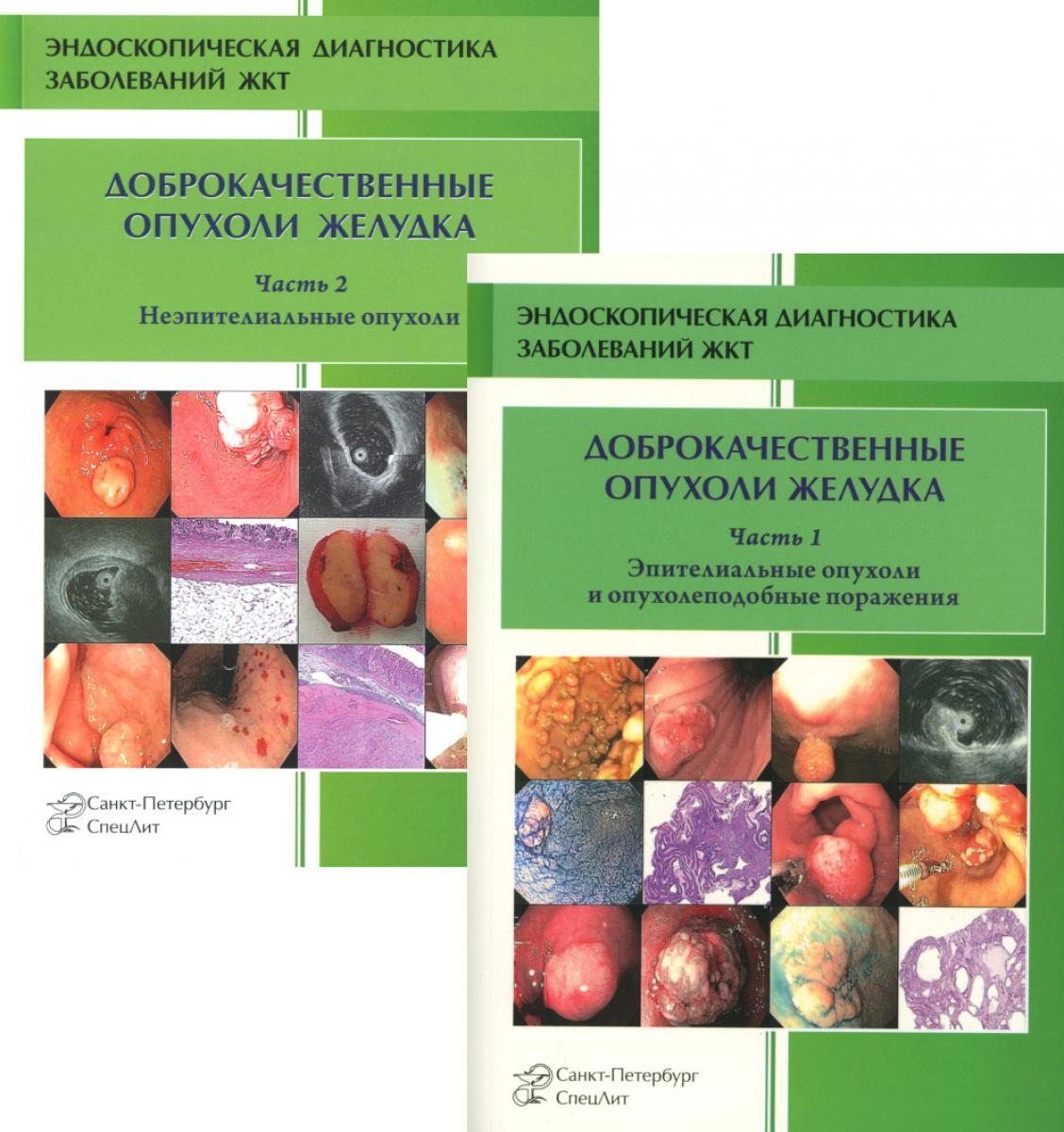 Доброкачественные опухоли желудка (комплект из 2-х книг)