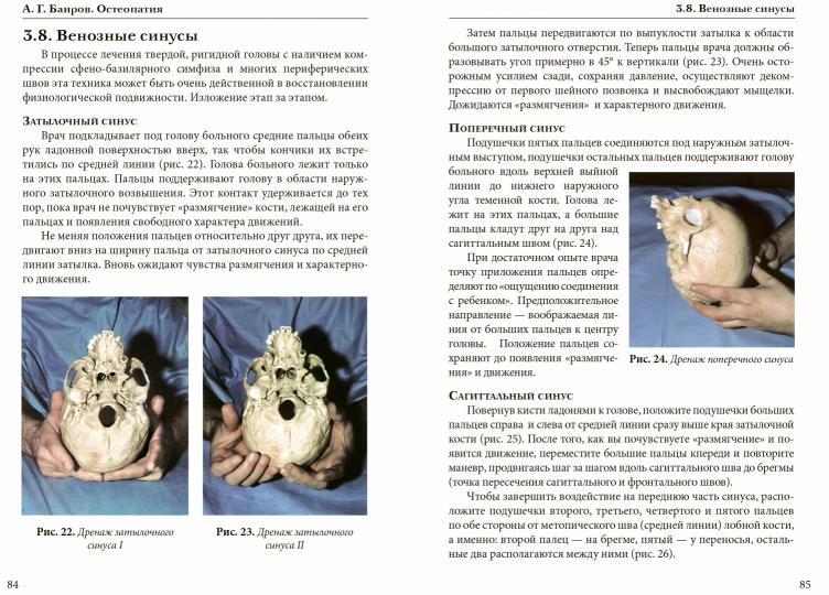 Ostéopatite