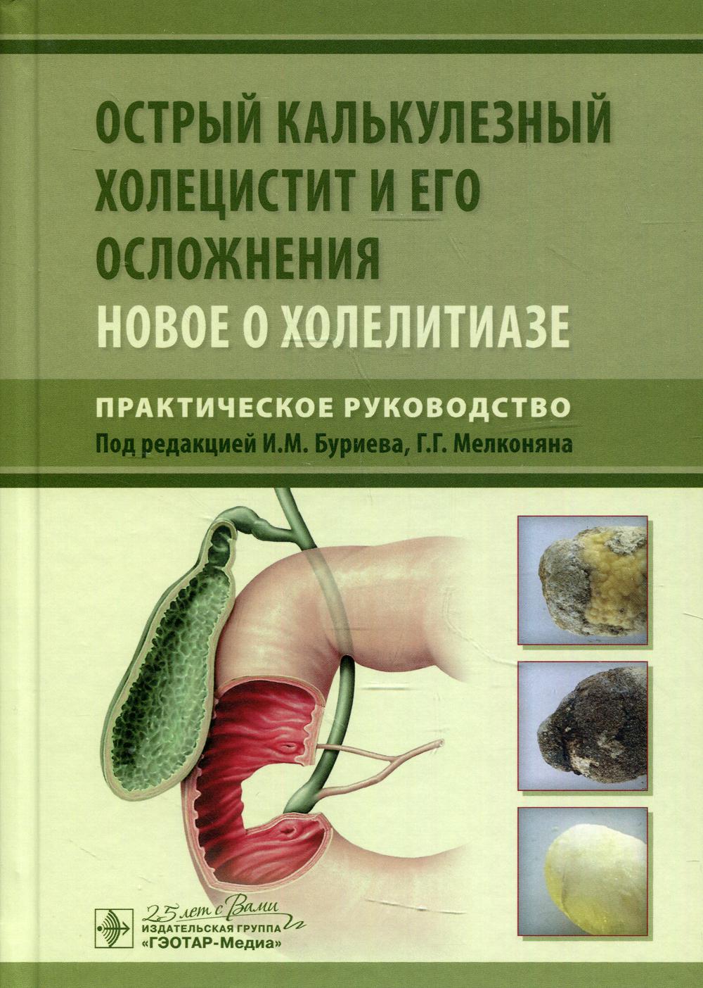 Острый калькулезный холецистит и его осложнения. Новое о холелитиазе. Практическое руководство / под ред. И. M. Буриева, Г. Г. Melconyanna. — Москва : ГЭОТАР-Медиа, 2020. — 272 с. : IL. —DOI : 10.33029/9704-5662-0-2020-OKH-1-272.