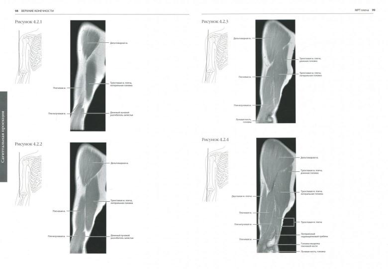 МРТ и КТ. Секционная анатомия