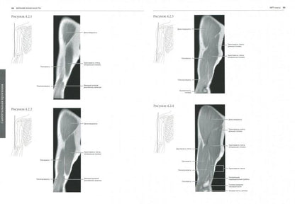 МРТ и КТ. Секционная анатомия