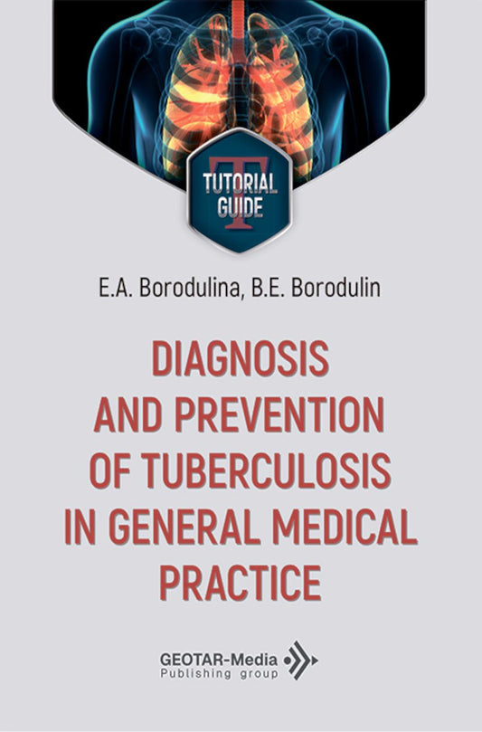 Diagnosis and prevention of tuberculosis in general medical practice = Диагностика и профилактика туберкулеза в общей врачебной практике