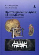 Протезирование зубов на имплантатах. 2-е изд., доп. Загорский В.А., Робустова Т.Г.