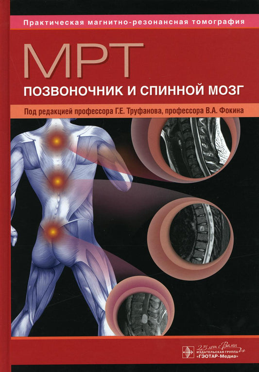 МРТ. Позвоночник и спинной мозг : руководство для врачей / под ред. Г. Е. Труфанова, В. А. Фокина. — Москва : ГЭОТАР-Медиа, 2020. — 544 с. : ил. — (Серия «Практическая магнитно-резонансная томография»). — DOI: 10.33029/9704- 4517-4-MRT-2020-1-544.