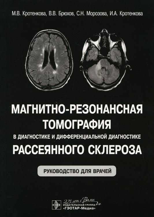 Магнитно-резонансная томография в диагностике и дифференциальной диагностике рассеянного склероза : руководство для врачей / М. В. Кротенкова и др. — Москва : ГЭО ТАР-Медиа, 2020. — 160 с. : ил.