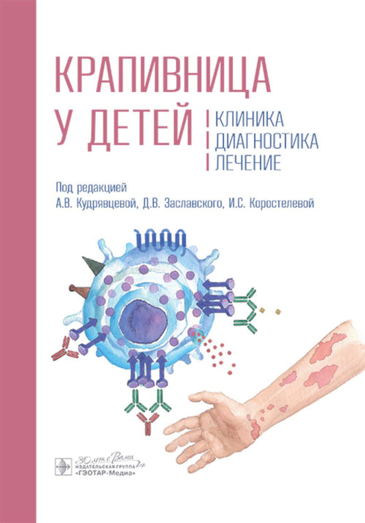 Крапивница у детей: клиника, диагностика, лечение / под ред. А. В. Кудрявцевой, Д. В. Заславского, И. С. Коростелевой. — Москва : ГЭОТАР-Медиа, 2025. — 136 c.