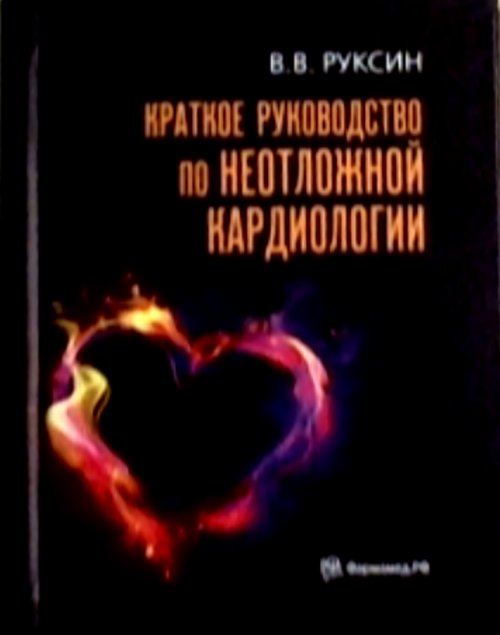 Cratkoe руководство по неотложной кардиологии. 4-е изд., перераб. je suis d'accord