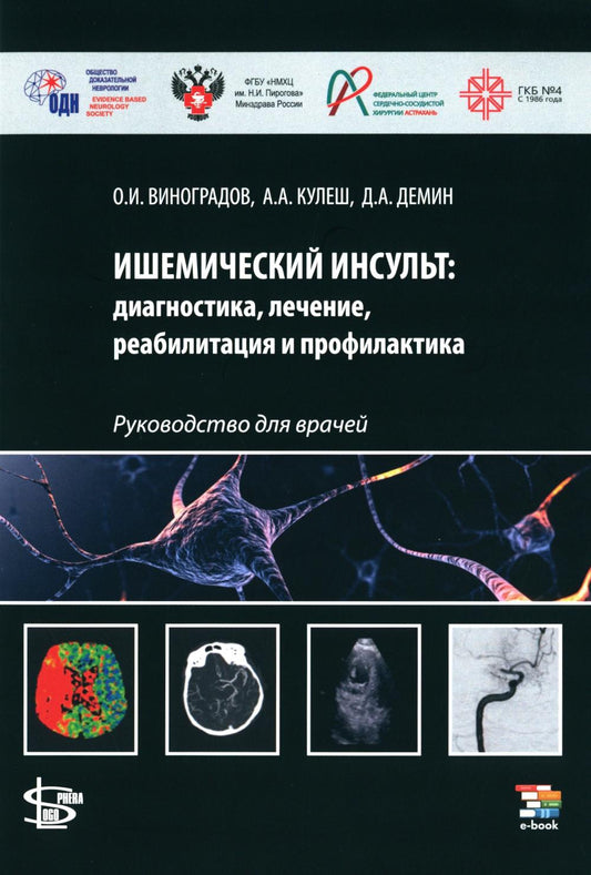 Ишемический инсульт: diagnostic, lecture, réadaptation et profil. Руководство для врачей