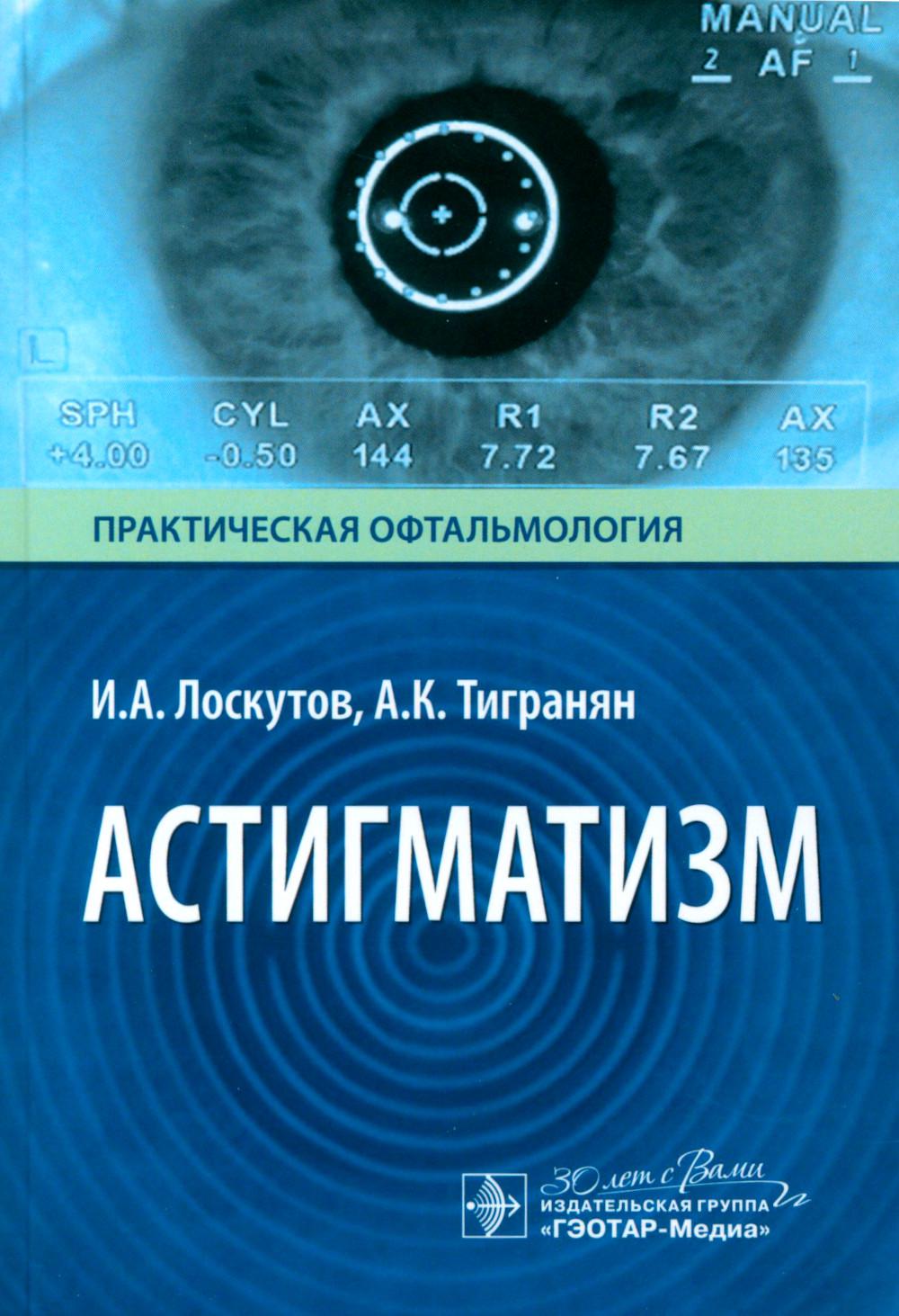 Астигматизм / И. A. Лоскутов, А. K. Tigre. —M. : ГЭОТАР-Медиа, 2024. — 192 с.: ил.