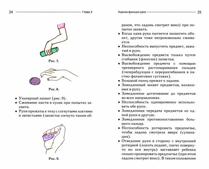 Терапия рук при спастических формах ДЦП