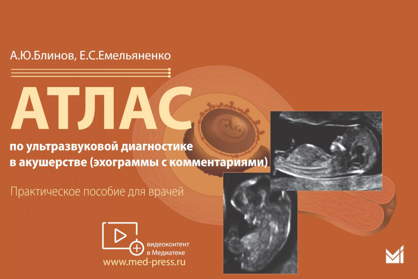 Atlas propose un diagnostic ultrasonique en matière d'acoustique (échogrammes avec commentaires) : pratique pour la maison
