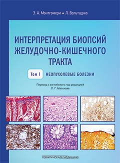 Интерпретация биопсий желудочно-кишечного тракта. Т. 1. Неопухолевые болезни. Монтгомери Э.А., Вольтаджо Л.